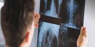 A Specialist Orthopaedic Centre: Things You Should Know Before You Go