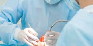 5 Beautiful Advantages of Dental Surgery Implants