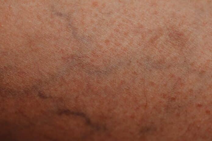 Human skin with visible texture and veins, showcasing natural patterns